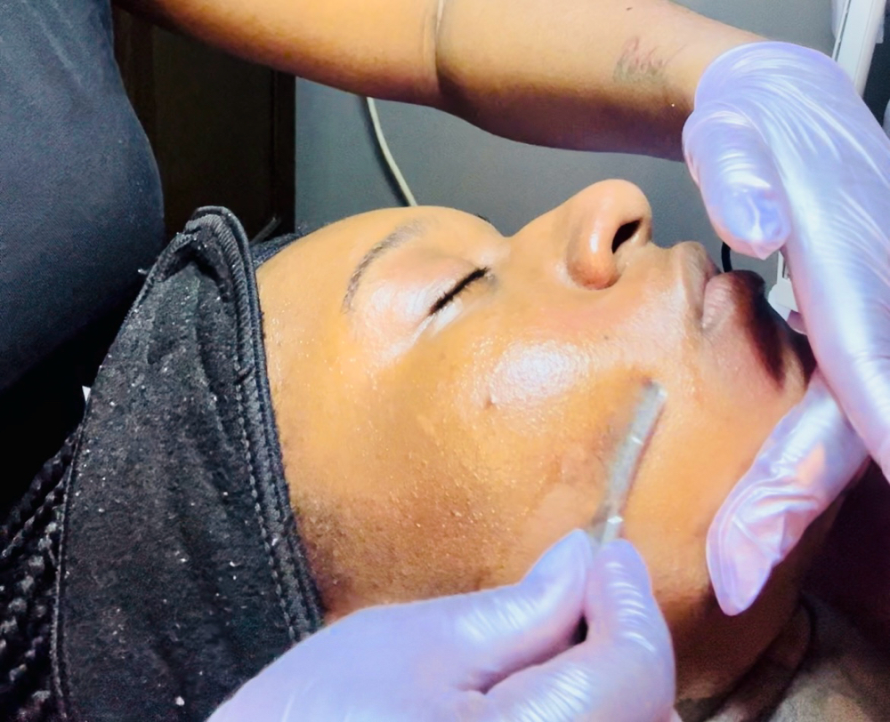 The Glow Treatment ✨