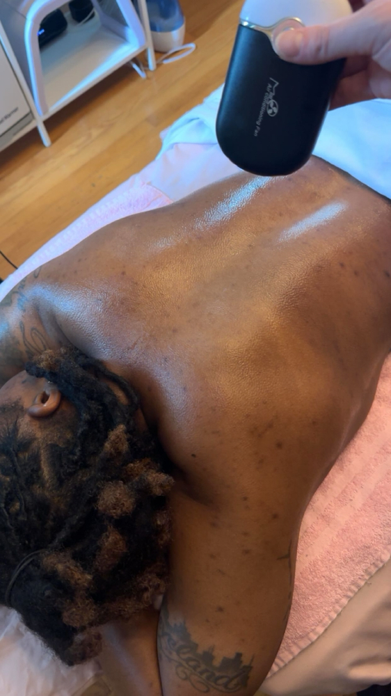 Body Chemical Peels