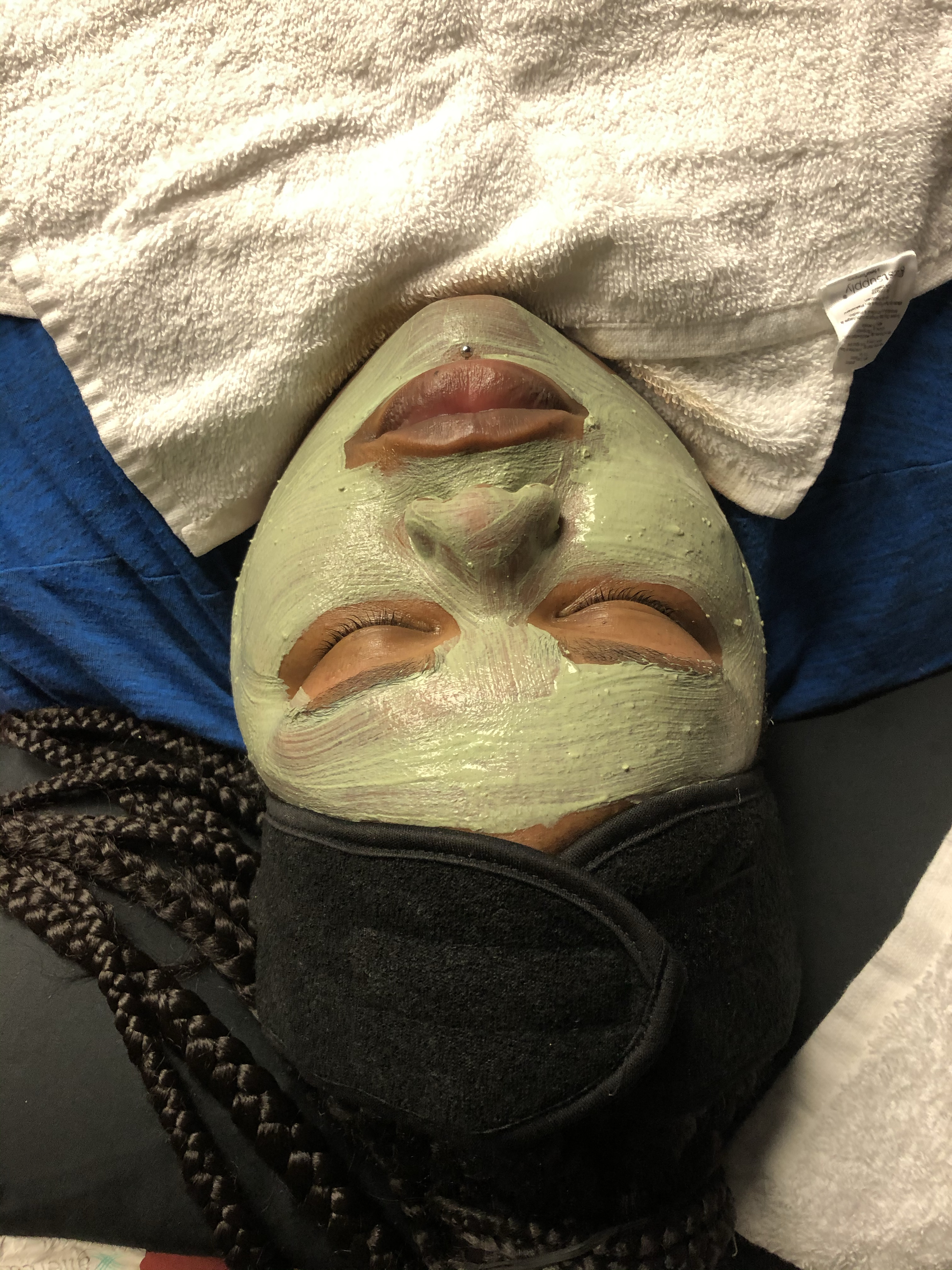 Acne Healing Skin Deep Facial