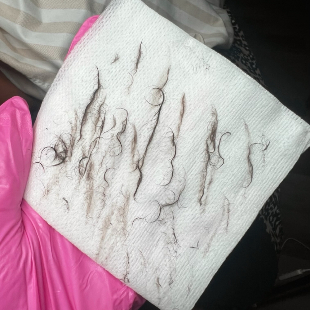Dermaplaning Facial at Skin by Payton Esthetics in Goldsboro, NC