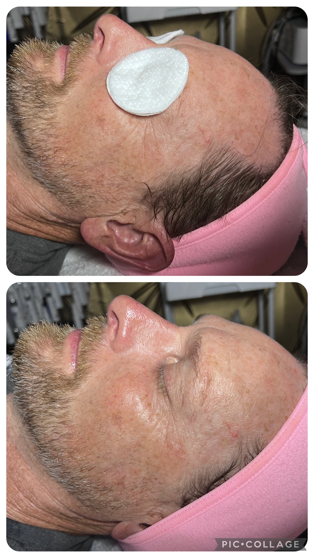 Gentlemen’s Facial