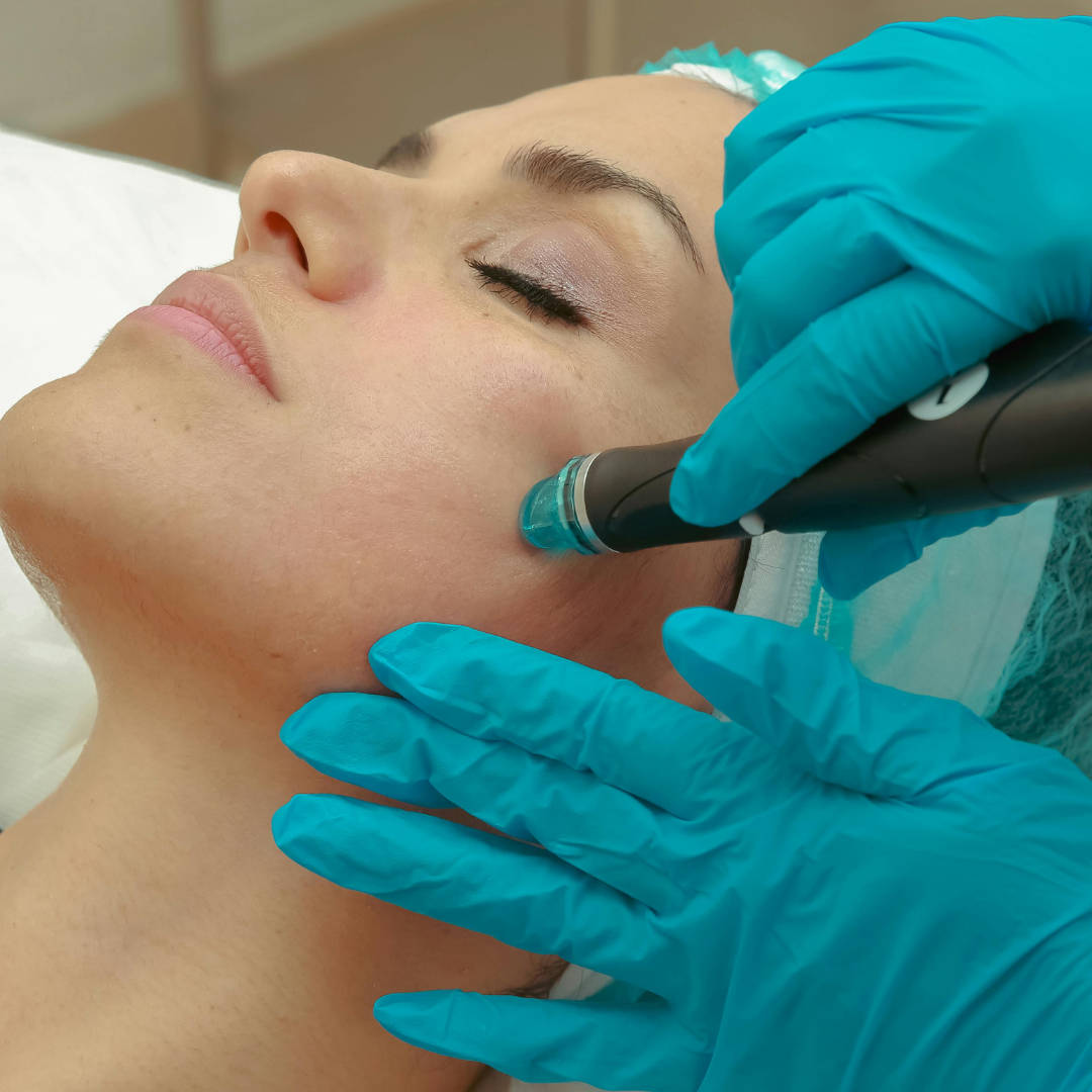 Hydrodermabrasion