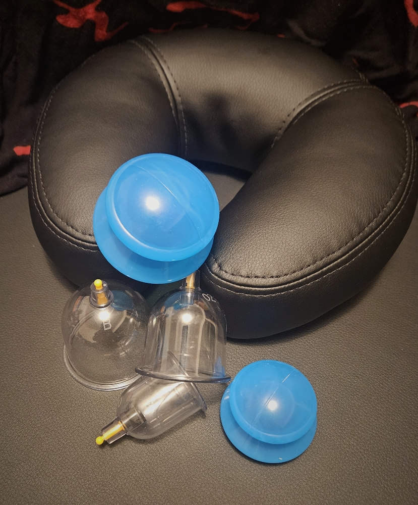 Cupping Therapy