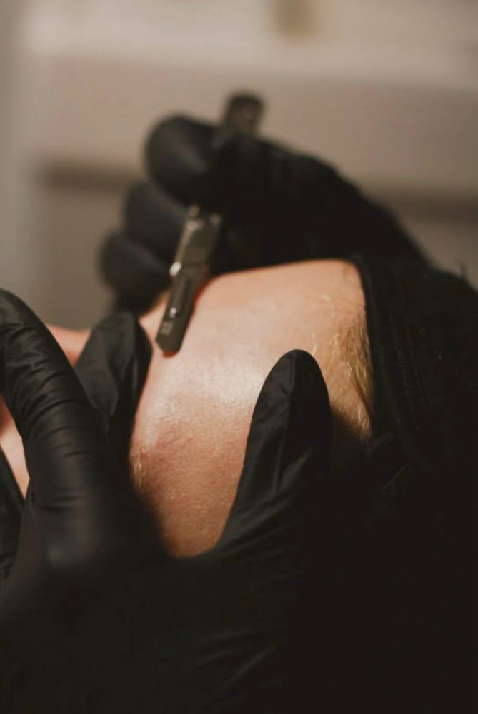 Dermaplane Facial at Pure Elegance Esthetics in North Andover, MA