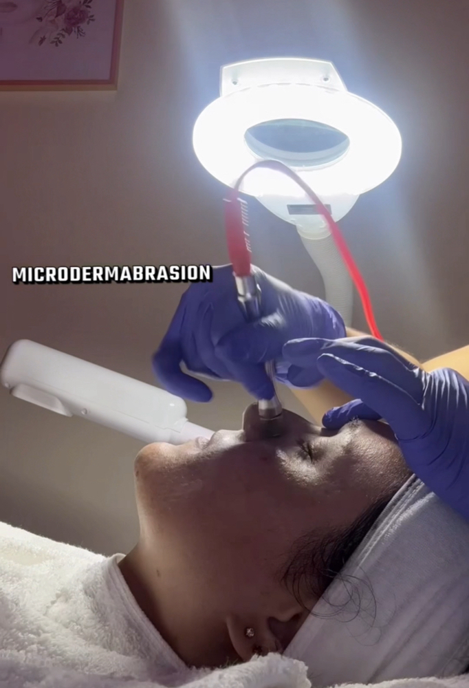 Facial w/Microdermabrasion