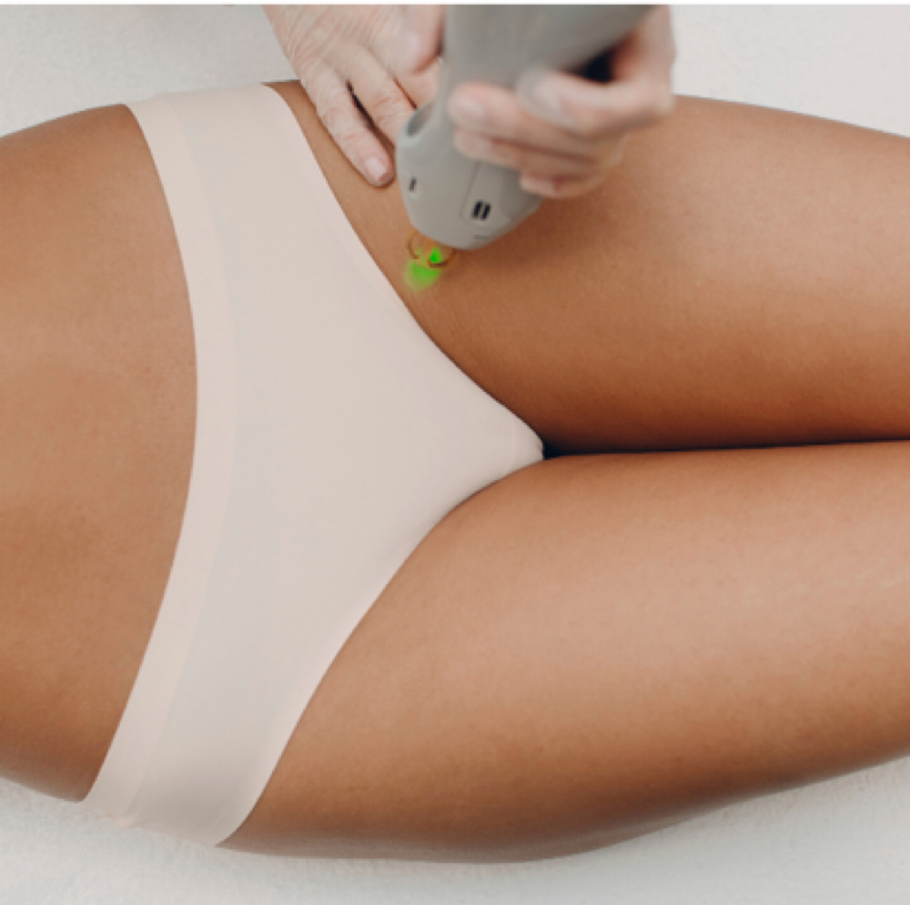 Laser Hair Reduction- Bikini at Joy to Beauty in Jupiter, FL
