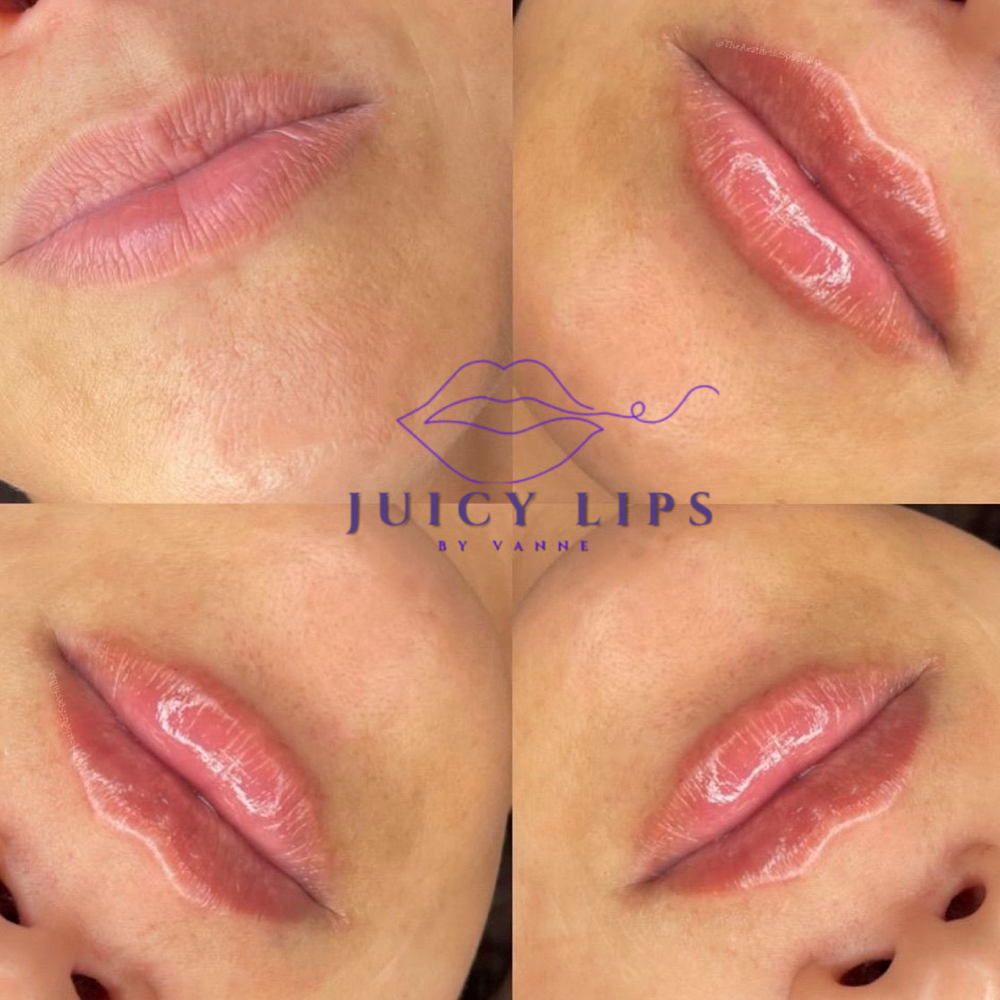 1 ML  Touch-up 2-4 Weeks at Dfwbrowsbyvannemorales.com in Fort Worth, TX