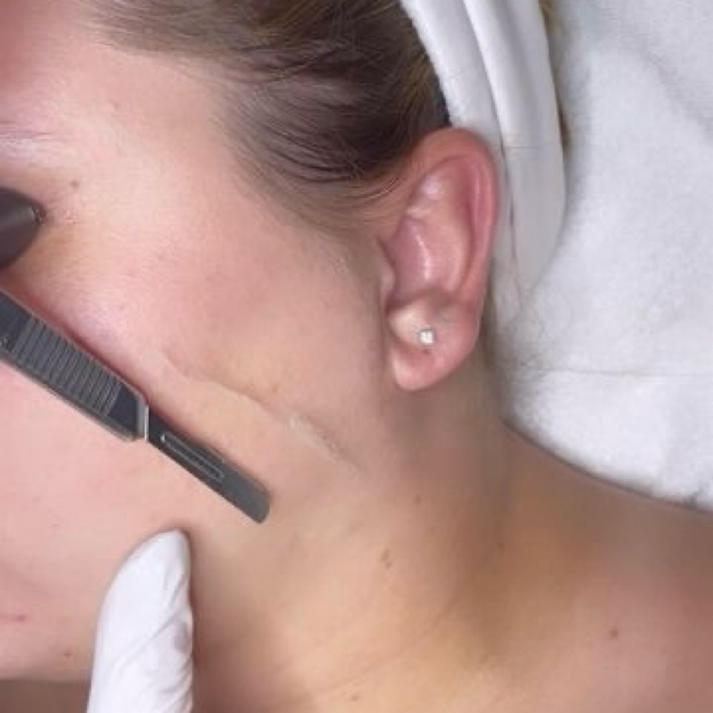 Dermaplane — Back On The Menu✨ at Katy At Wave Salon & Spa in Winchester, IN
