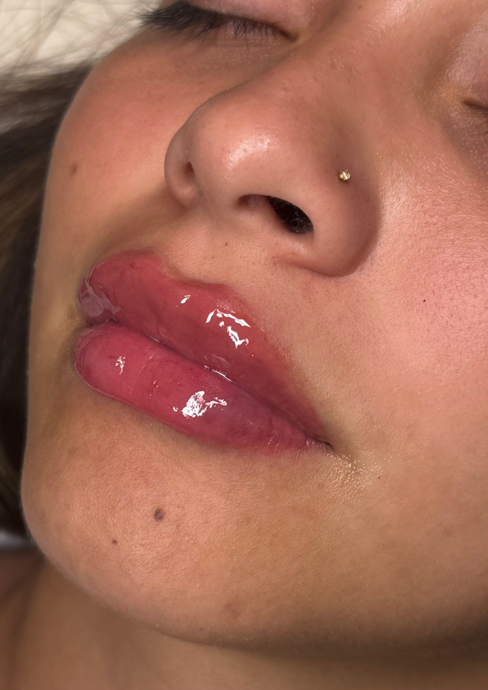 Doll Lips 1 ML