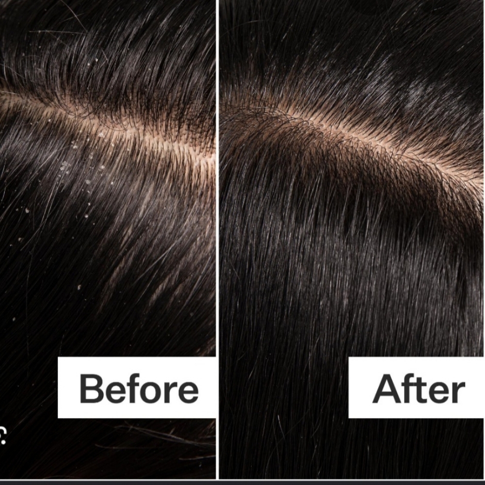 Scalp Cleanse at HAIR BY KASI in Sour Lake, TX