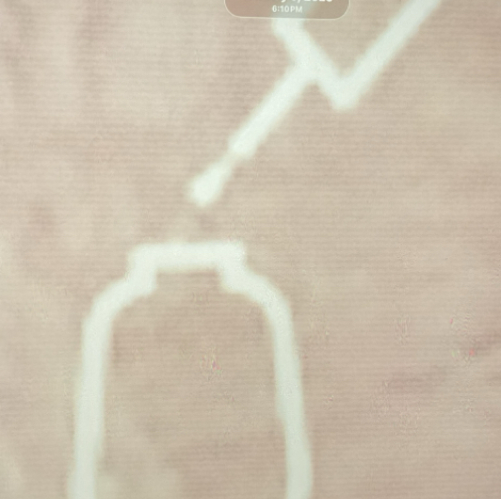 All Over Semi/ Demi permanent at Kim Young Hair in Santa Monica, CA