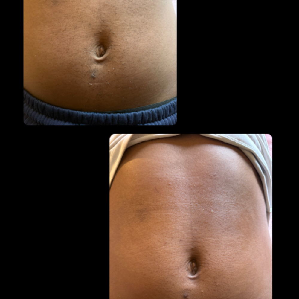 Stomach Wax at Da’Jah Hemsley in Largo, MD