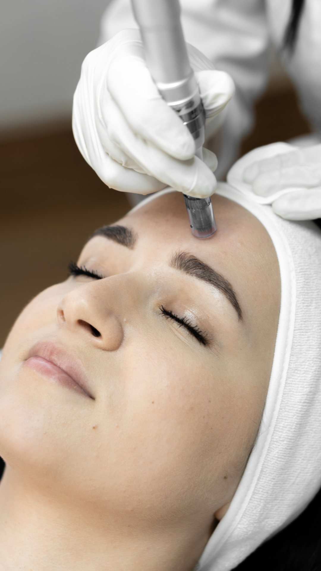 MicroNeedling