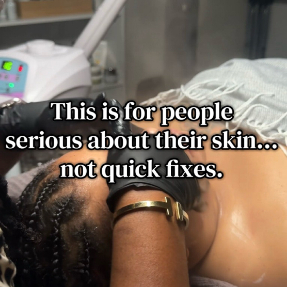 CHEMICAL PEEL SERIES