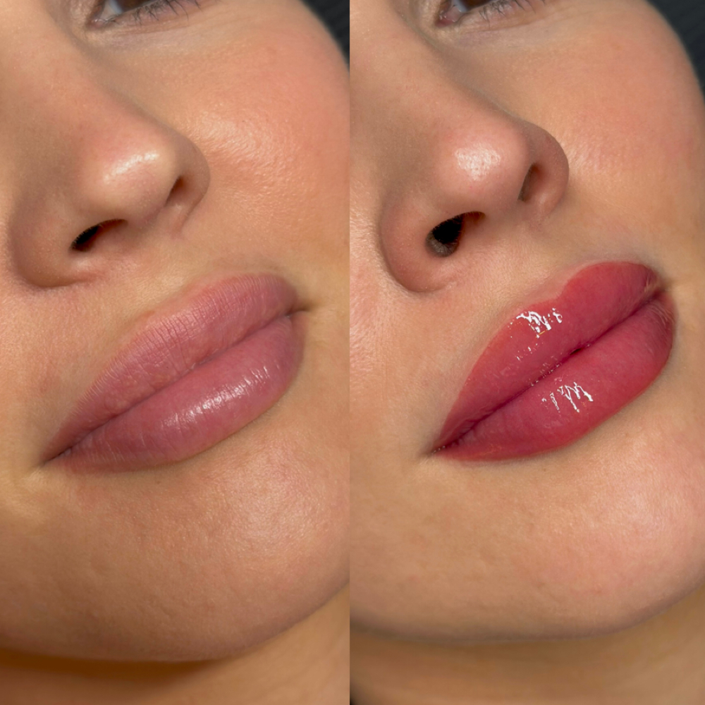 Lip Blush First Session at The Aesthetic Artisan in Palm Beach Gardens, FL