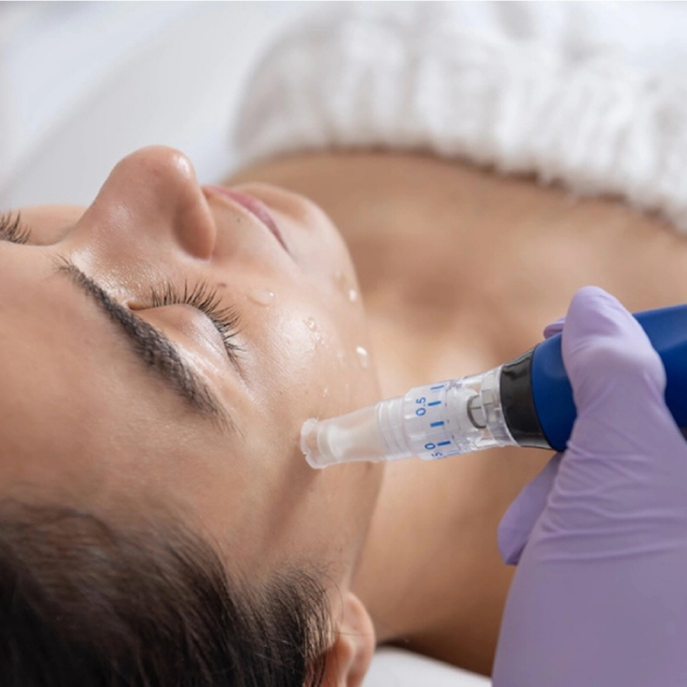 Skinpen Microneedling Face & Neck at Anfissa Beauty in Mount Angel, OR