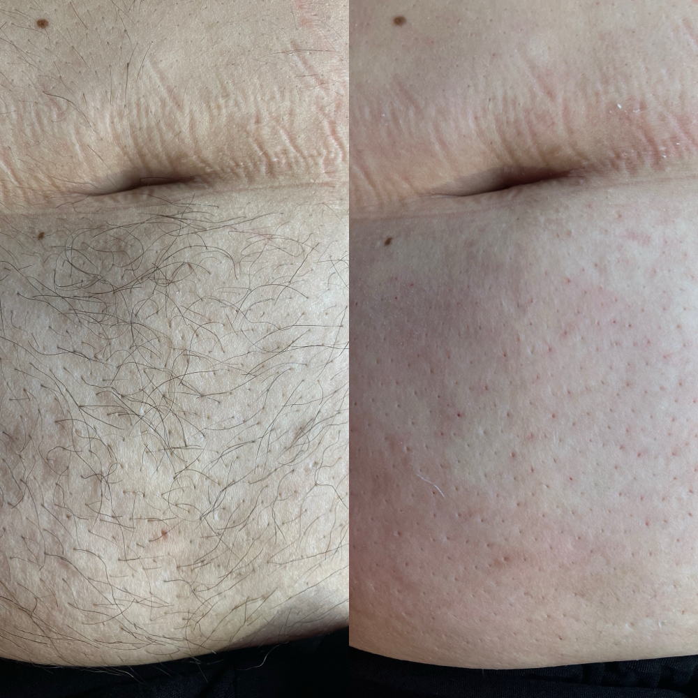 Womens Navel Strip