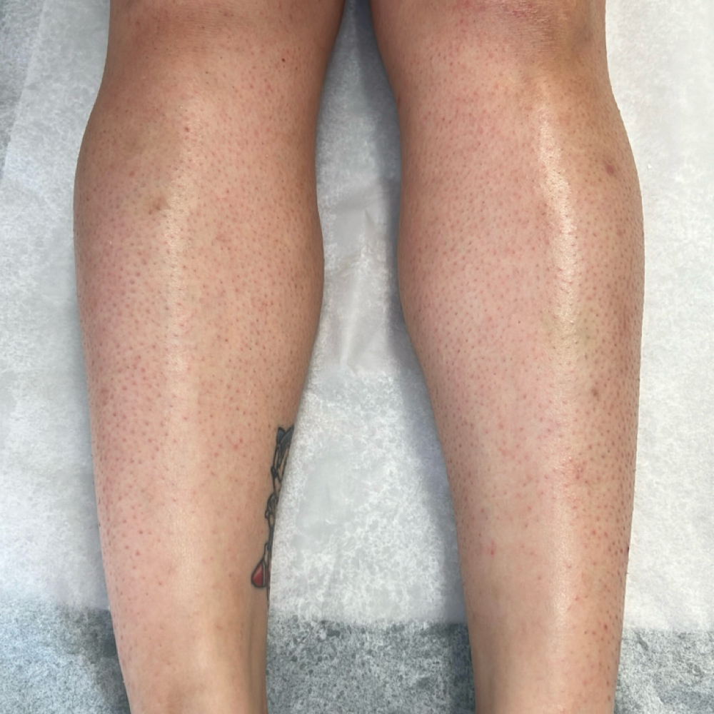 Half Leg at Simply Waxed in Fontana, CA