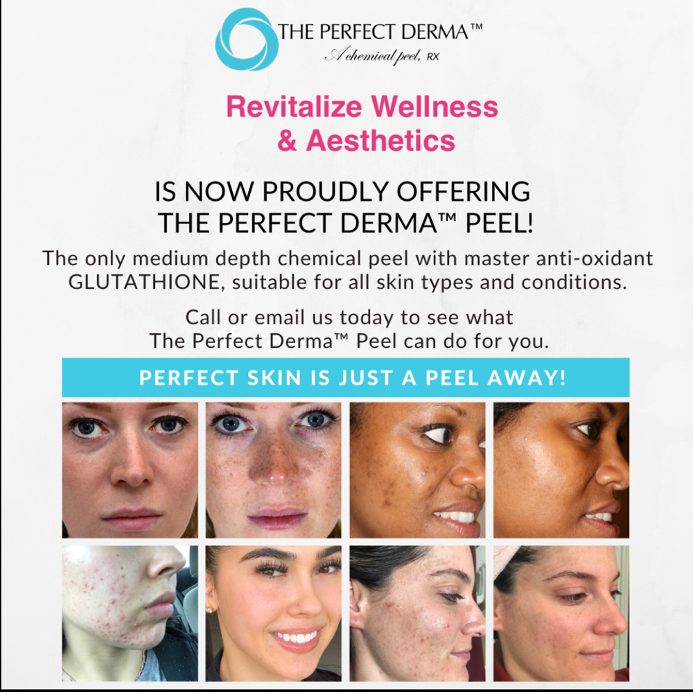 Perfect Derma Peel