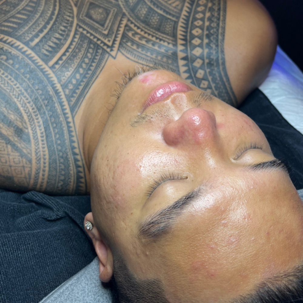 HYDRAFACIAL at SBM SKIN STUDIO in Whittier, CA
