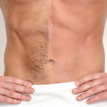 Full Stomach at Bareline Aesthetics in Brea, CA