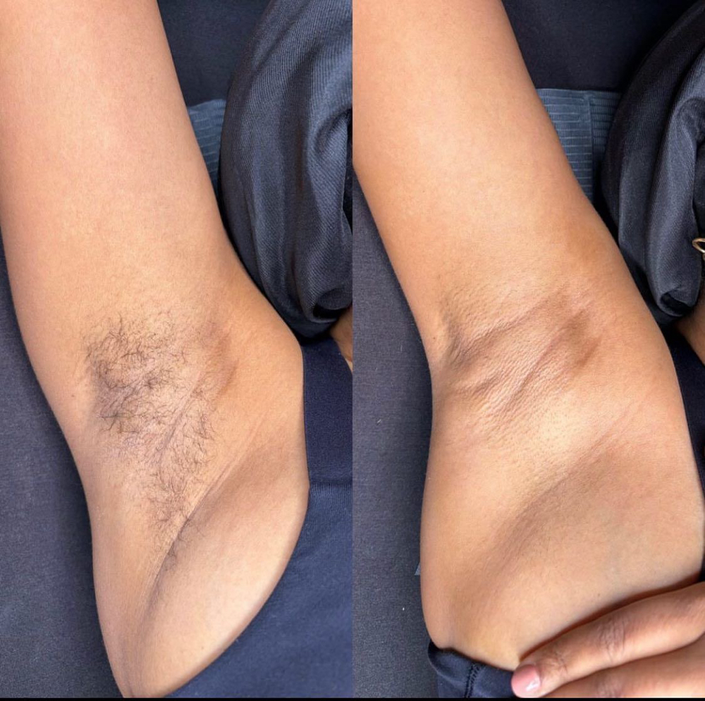 Underarm Wax