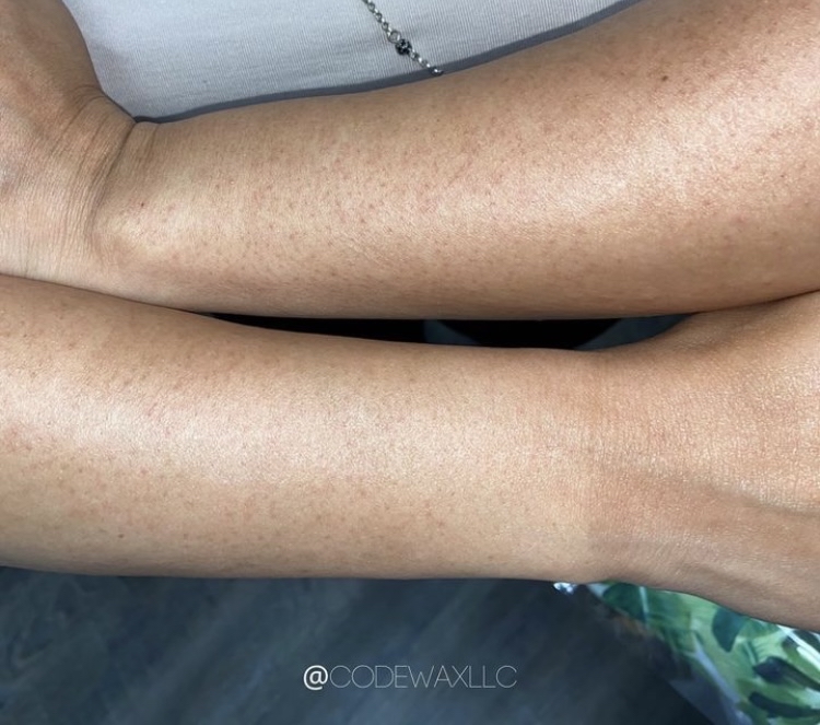 Half Arms