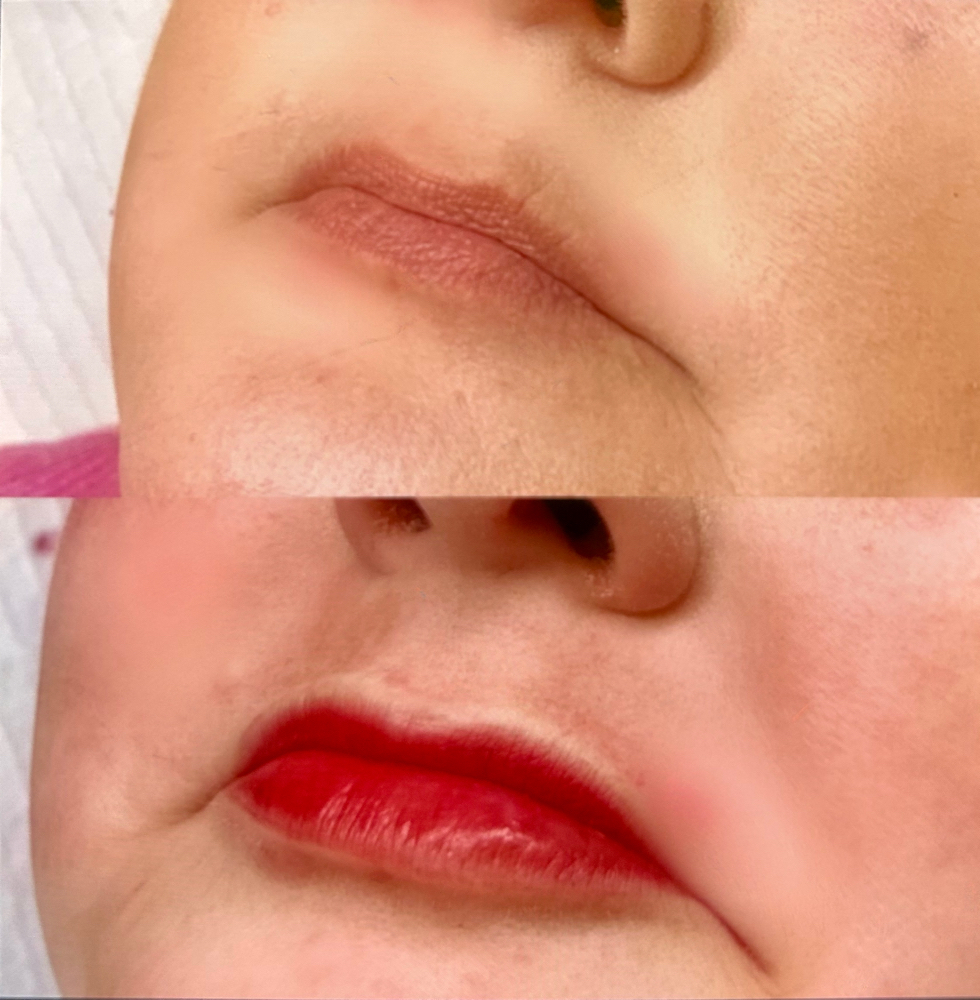 Lip Blushing