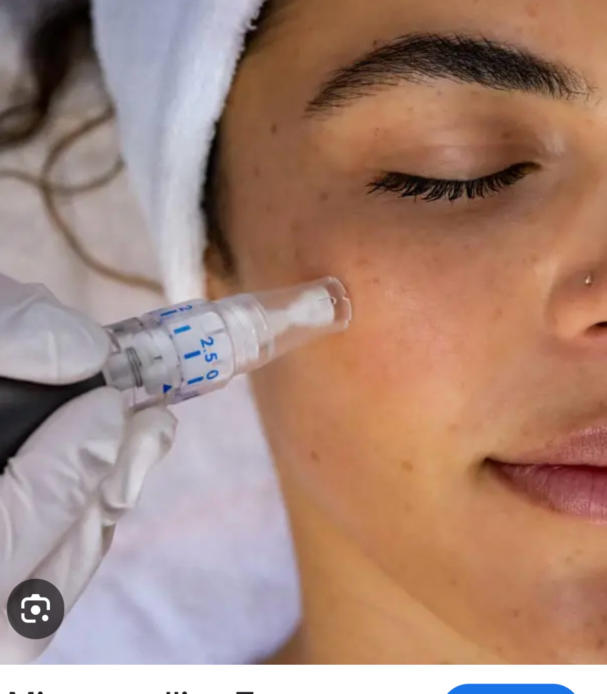Microneedling