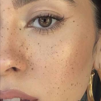 Signture Sun-Kissed Freckles at Taylor  Leeann Aesthetics in Ventura, CA