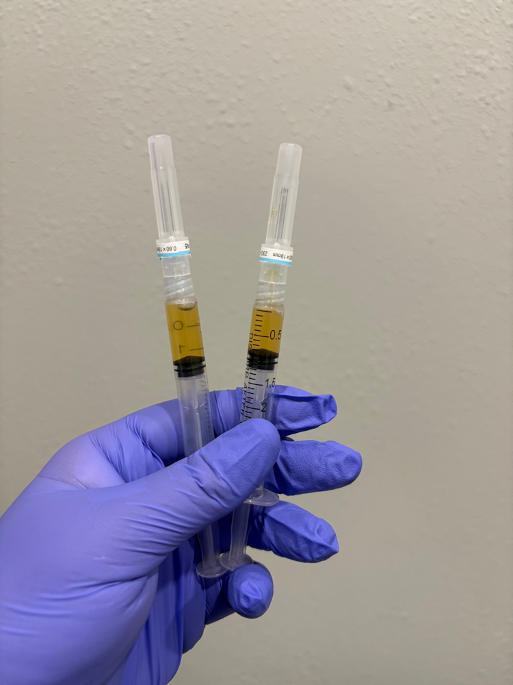 PRP Injections