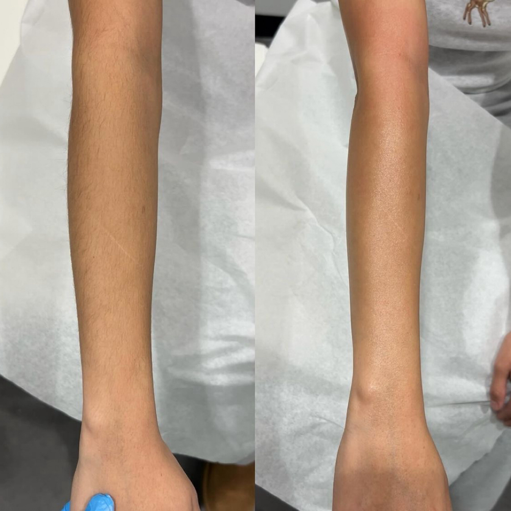 Full Arms at Idaho Beauty Lounge in Eagle, ID