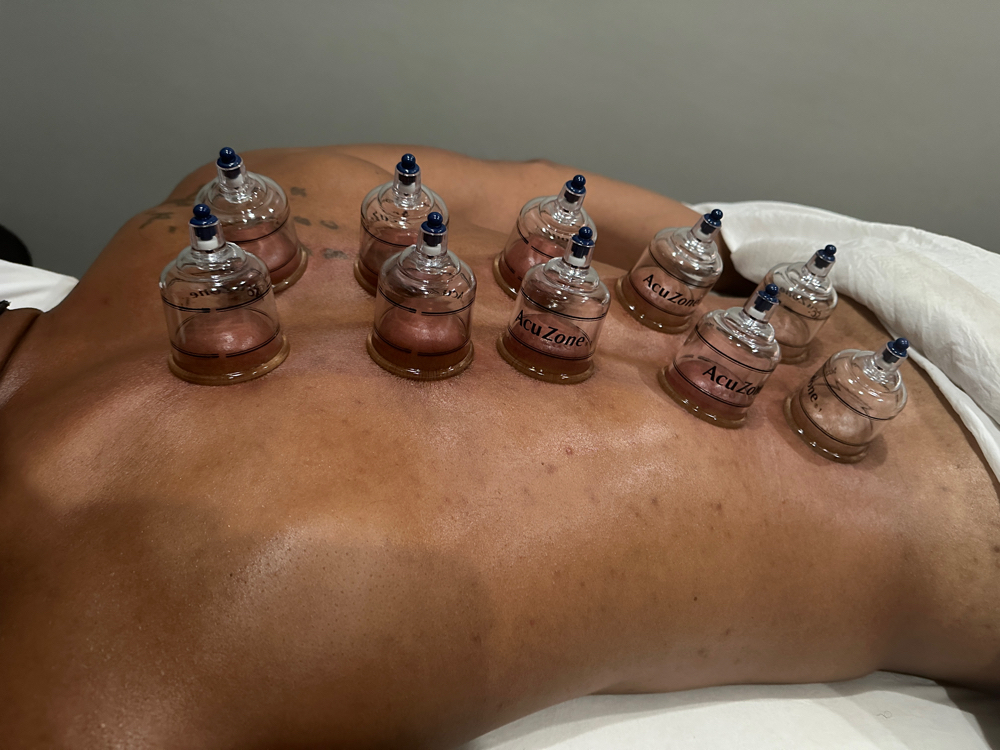 Cupping Add-on