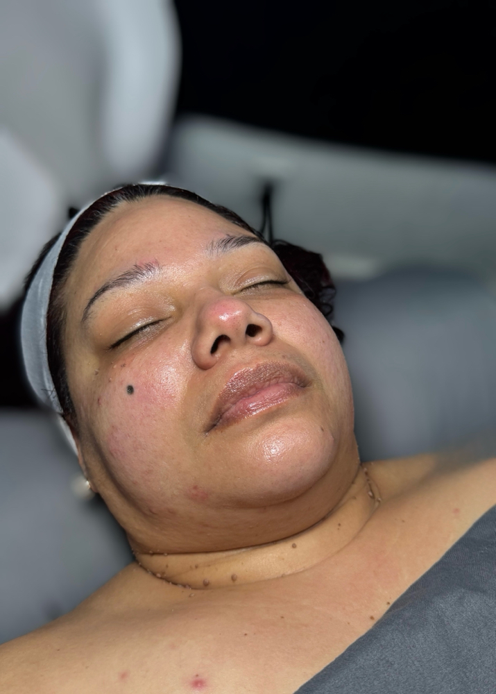 Hydra-Renew Facial ❣️