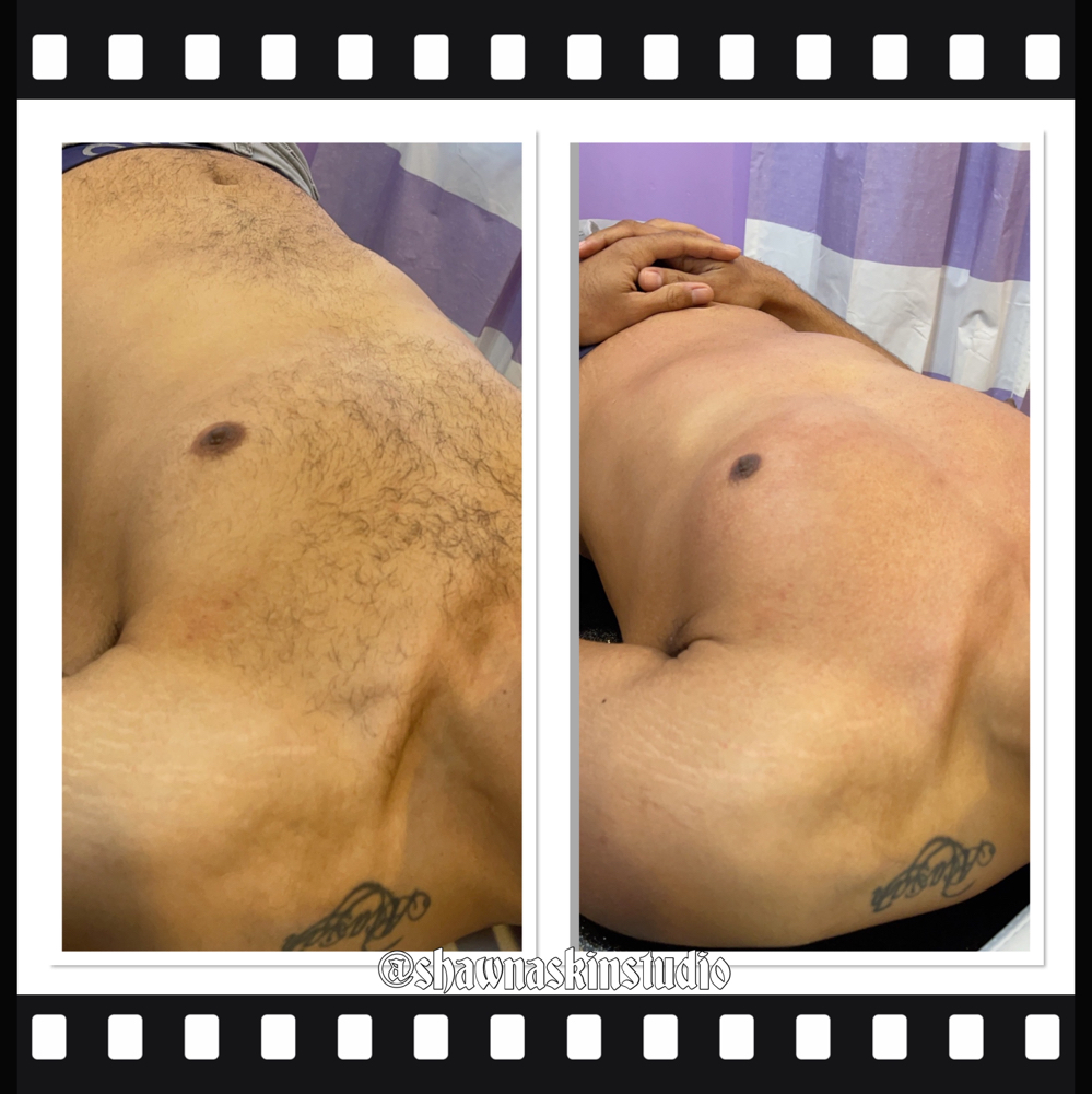Chest Wax