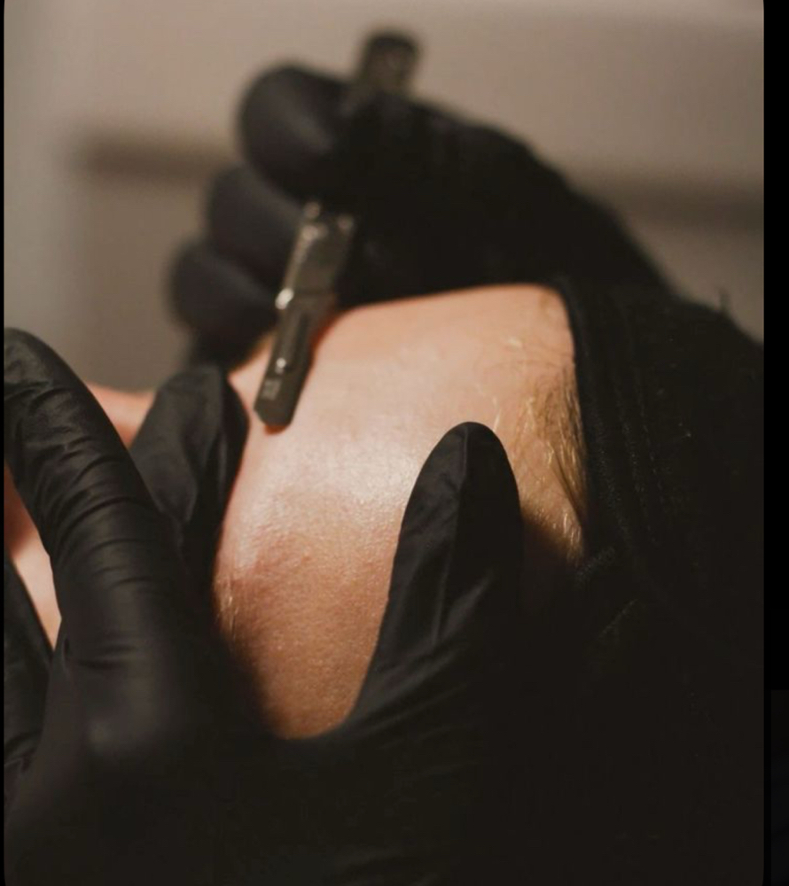 Dermaplane Facial