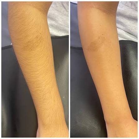 Full Arms Waxing at LET ME GLOW STUDIO in Powder spring, GA
