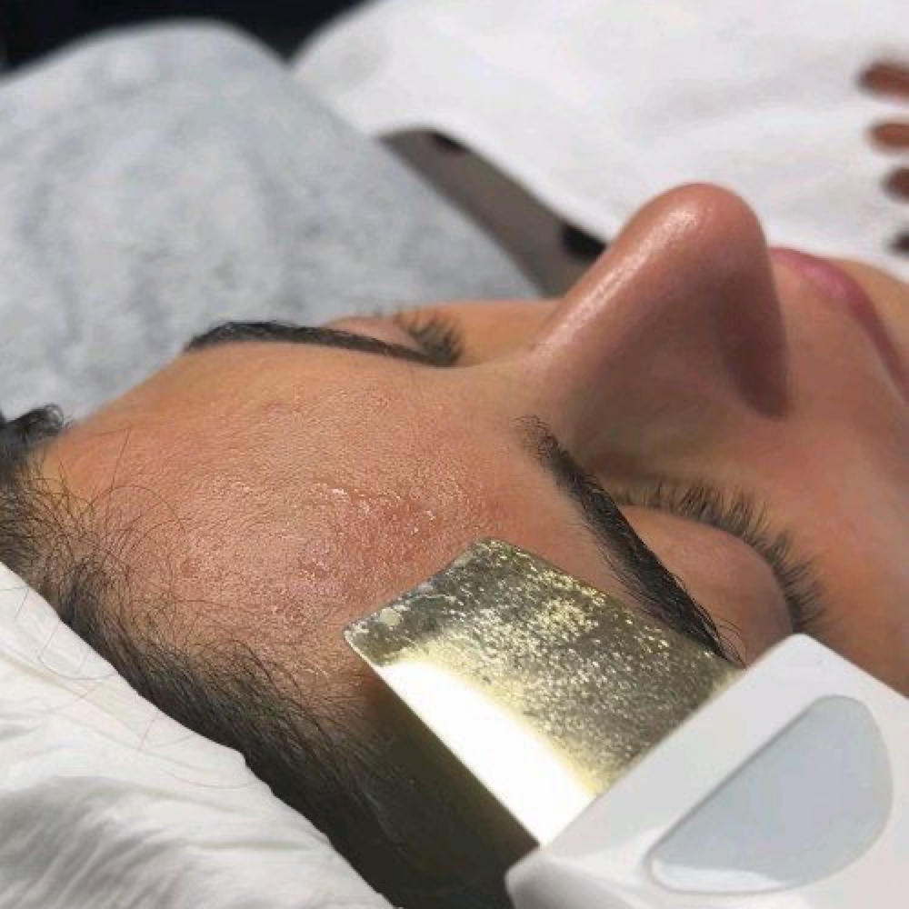 Acne facial at Nw2d Salon Fayetteville in Fayetteville, AR