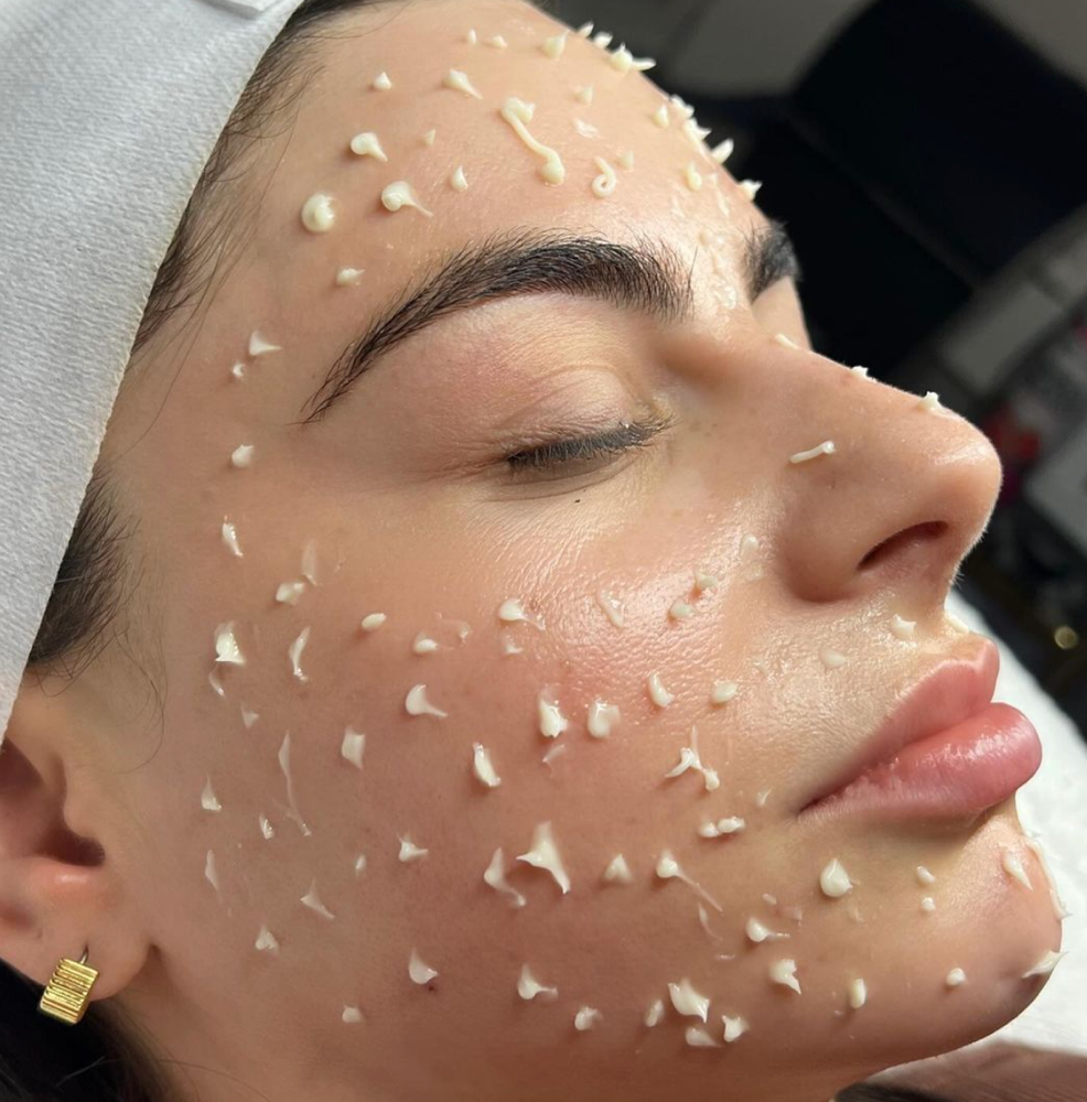 Liquid Microneedling