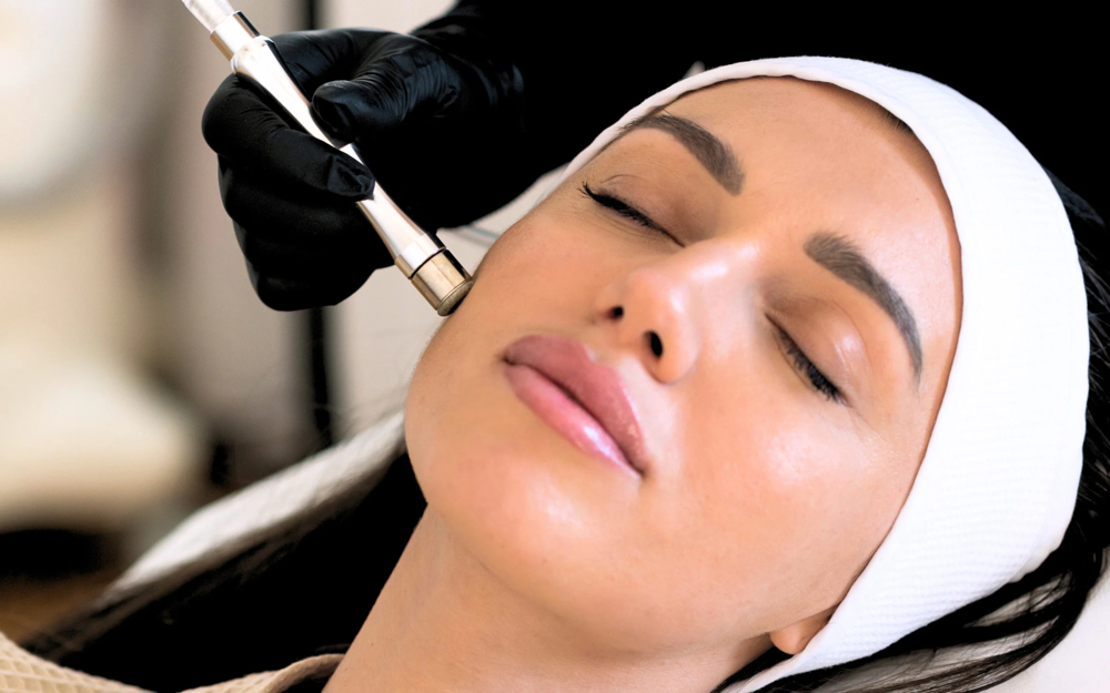 Diamond Microdermabrision