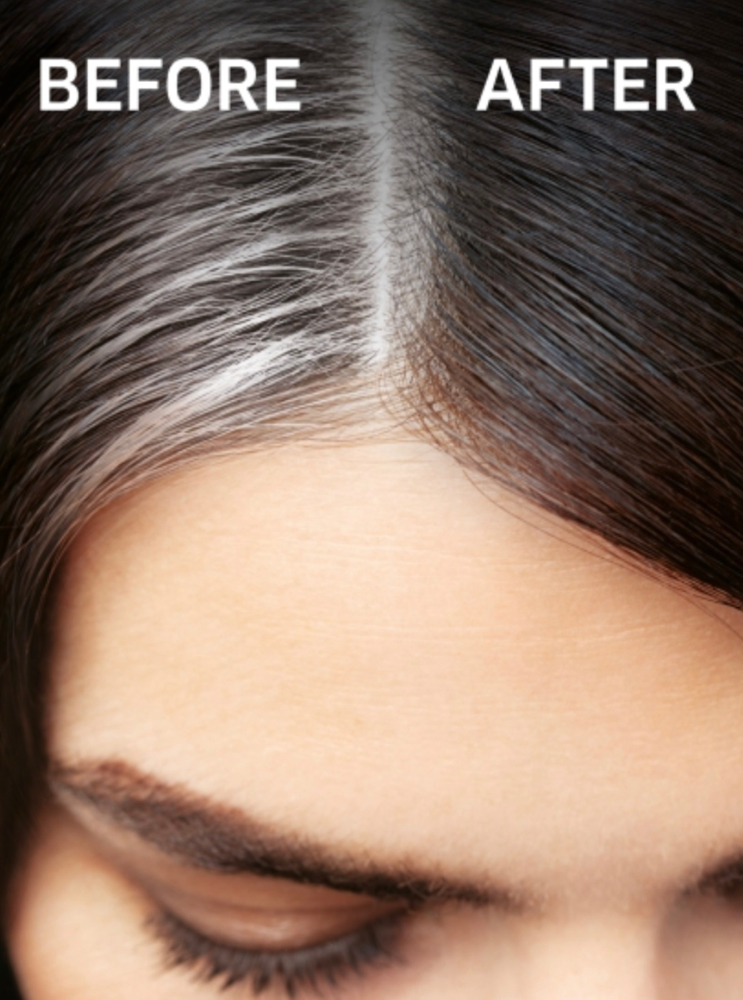 Root Retouch