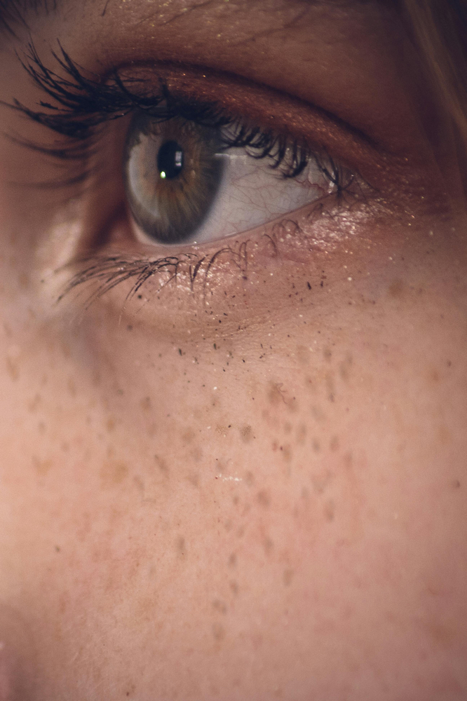 LASH REMOVAL
