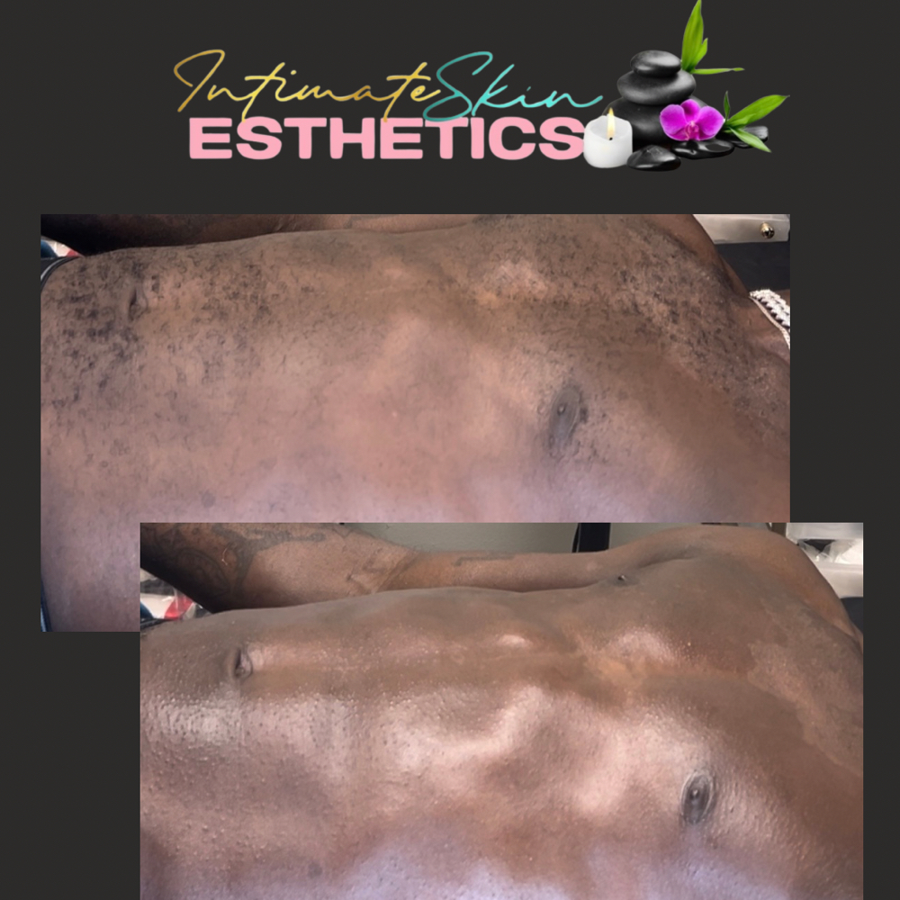 Body Waxing at Rockii’s intimate skin & esthetics in Va Beach, VA