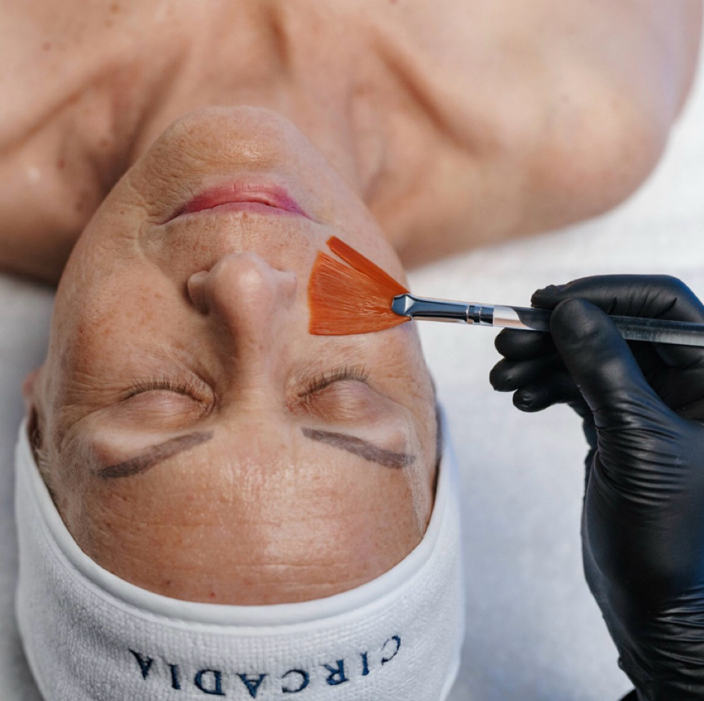 SWiCH Treatment at Storybook Skin in Ogden, UT