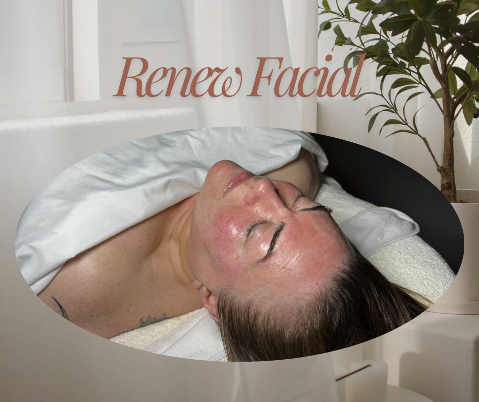 RENEW FACIAL