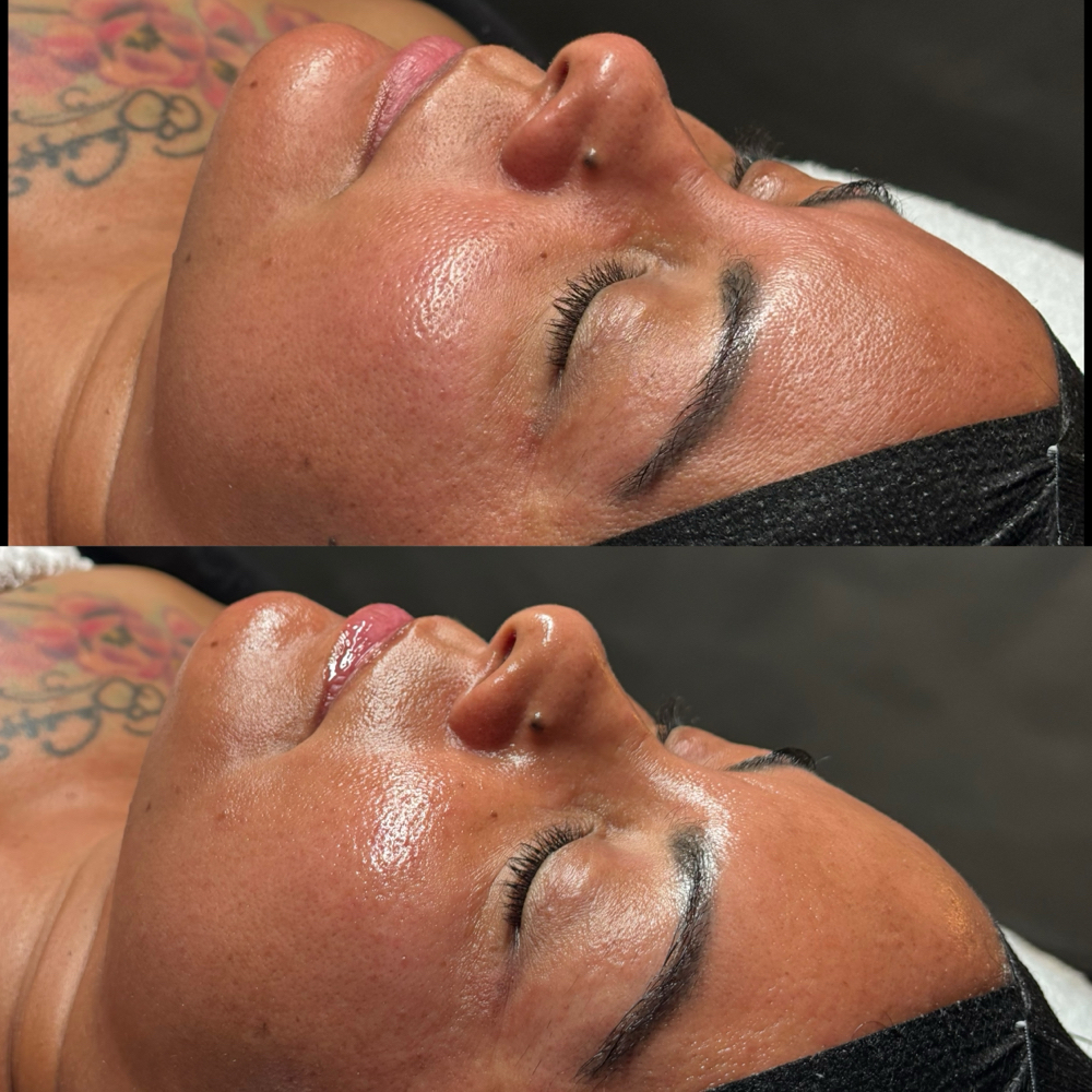 Korean V-Tox Lift Facial at Ur Glow Esthetician in Tarpon Springs, FL