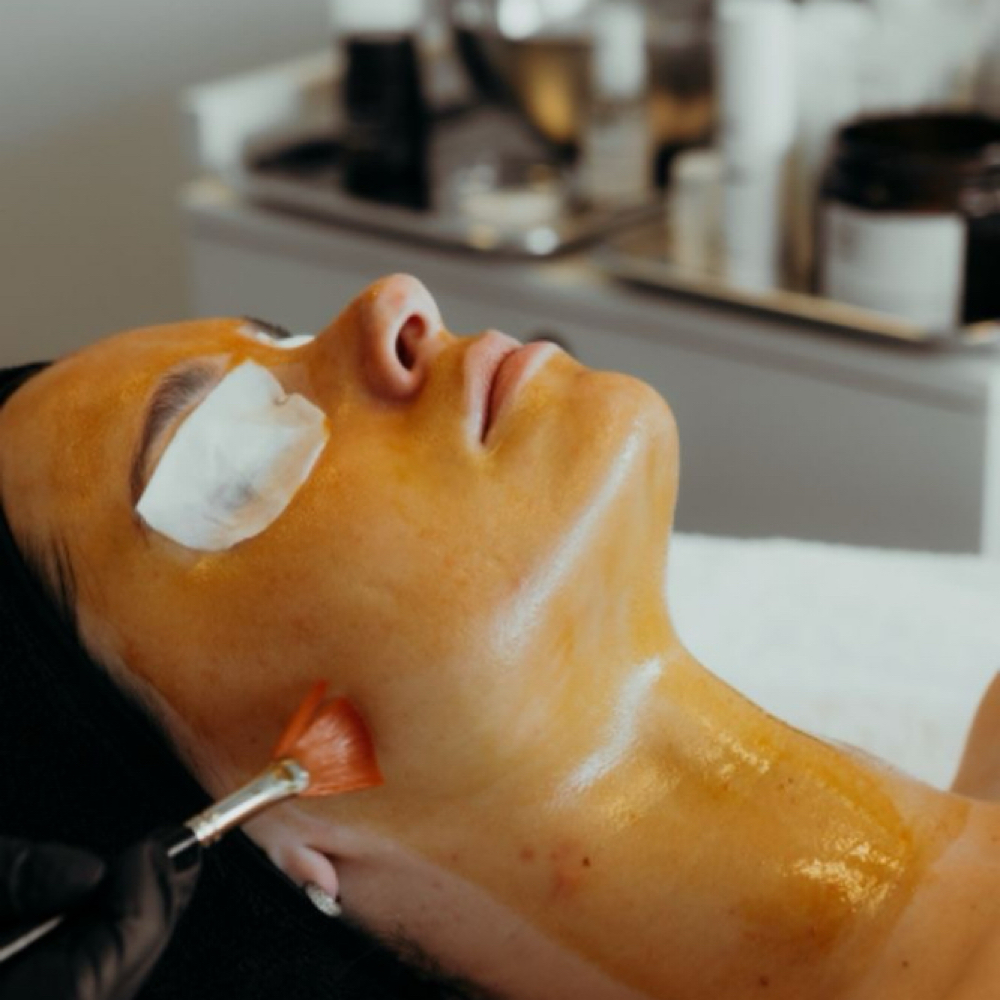 Chemical Peel Add-On at Lex Esthetics in Sparks, NV