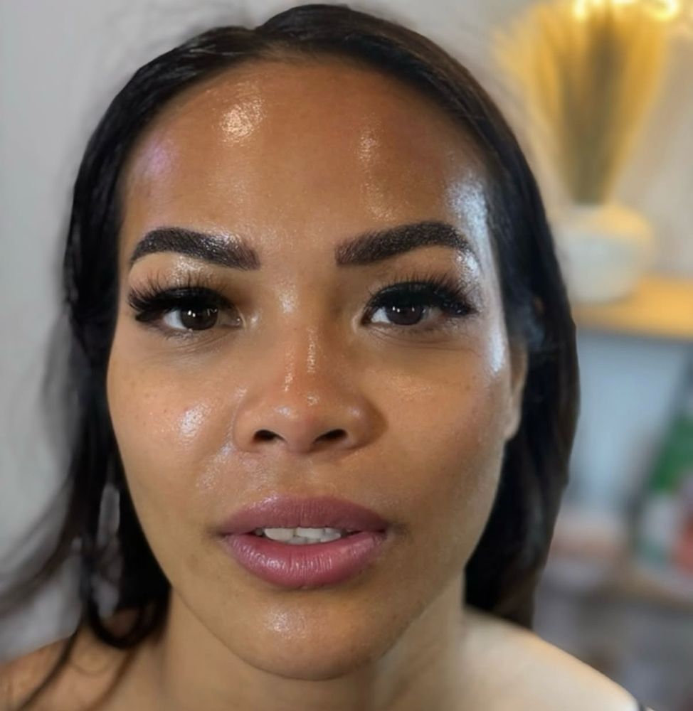 Medical Microneedling + SERUM