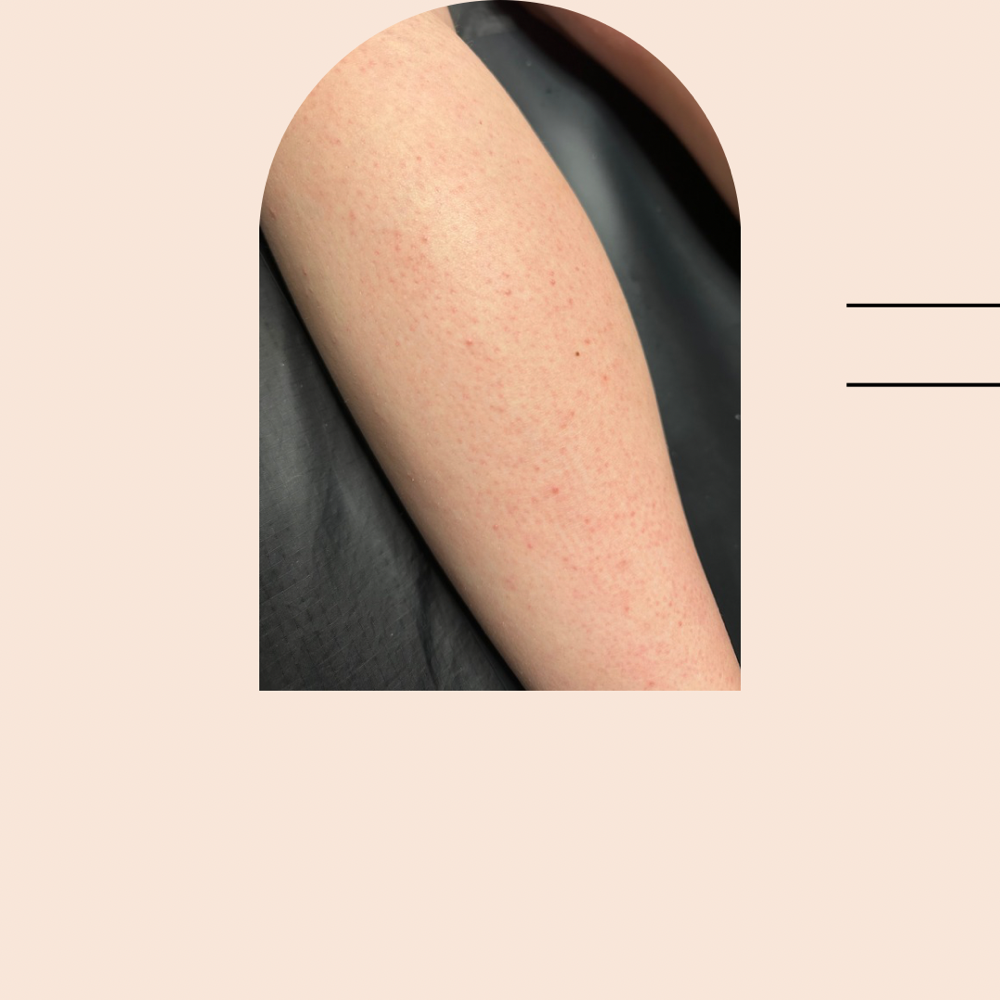 Leg Waxing at Reverie Skin Lab in London, KY