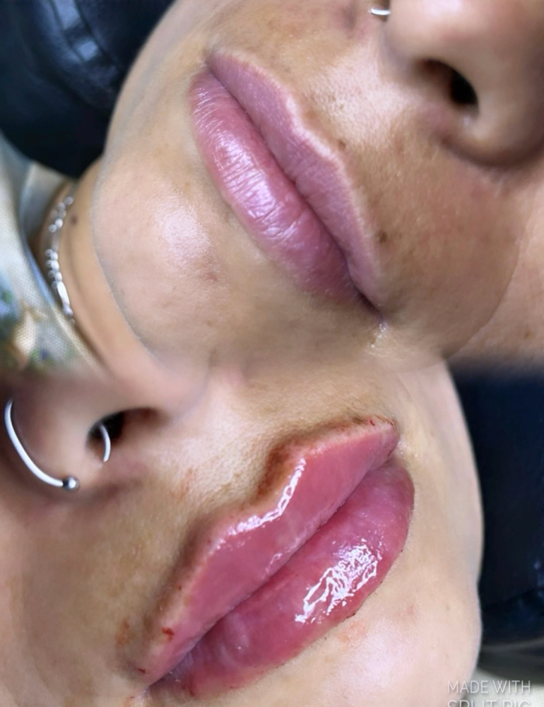 Russian Lips 1.5ml